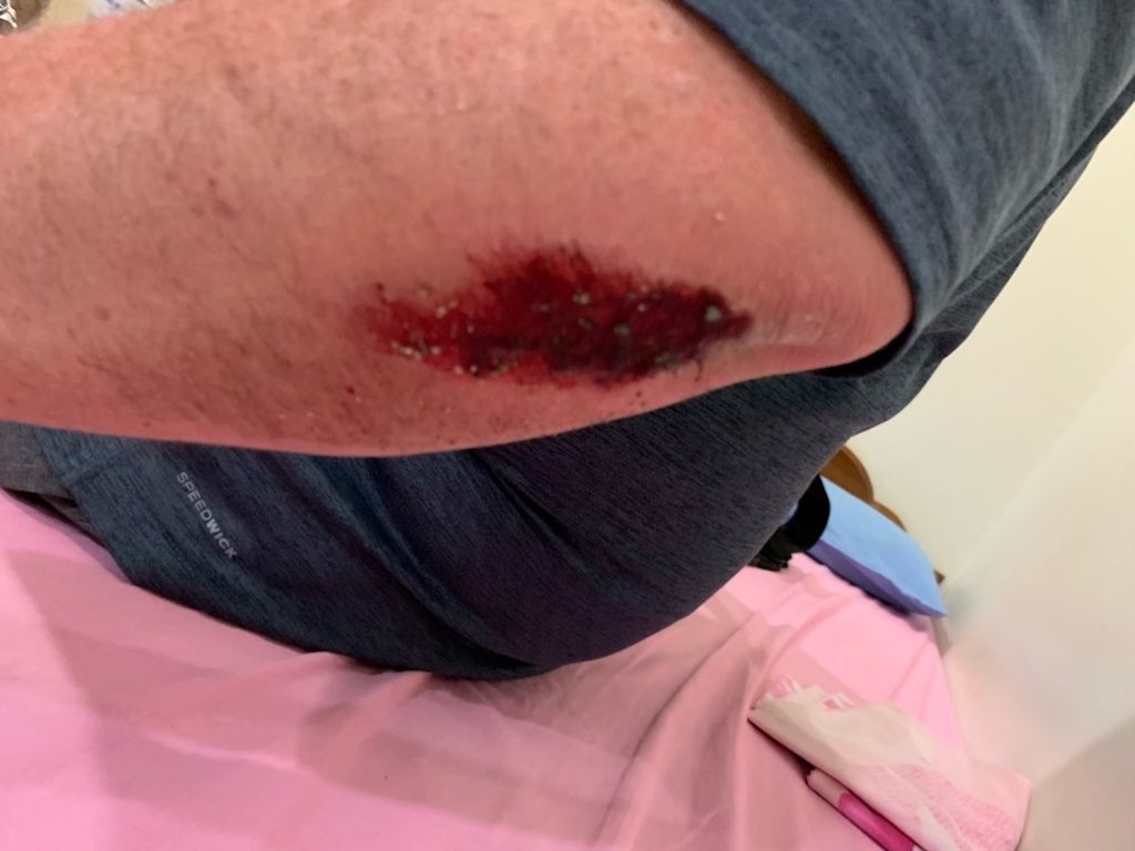 Motorcycle Accident Prachuap Khiri Khan